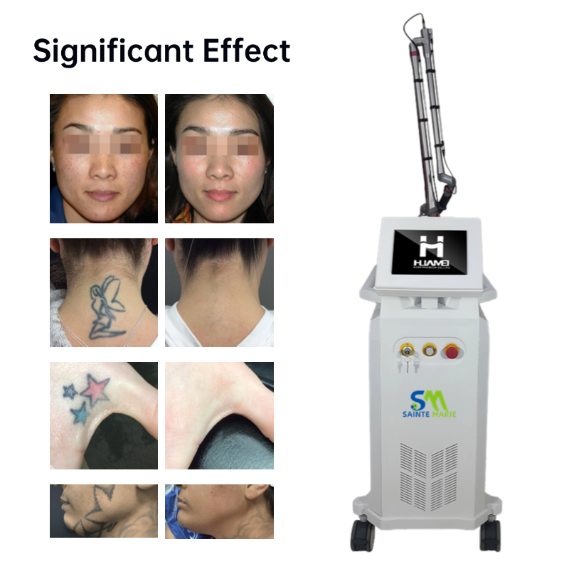 Alat Super Laser Picosecond