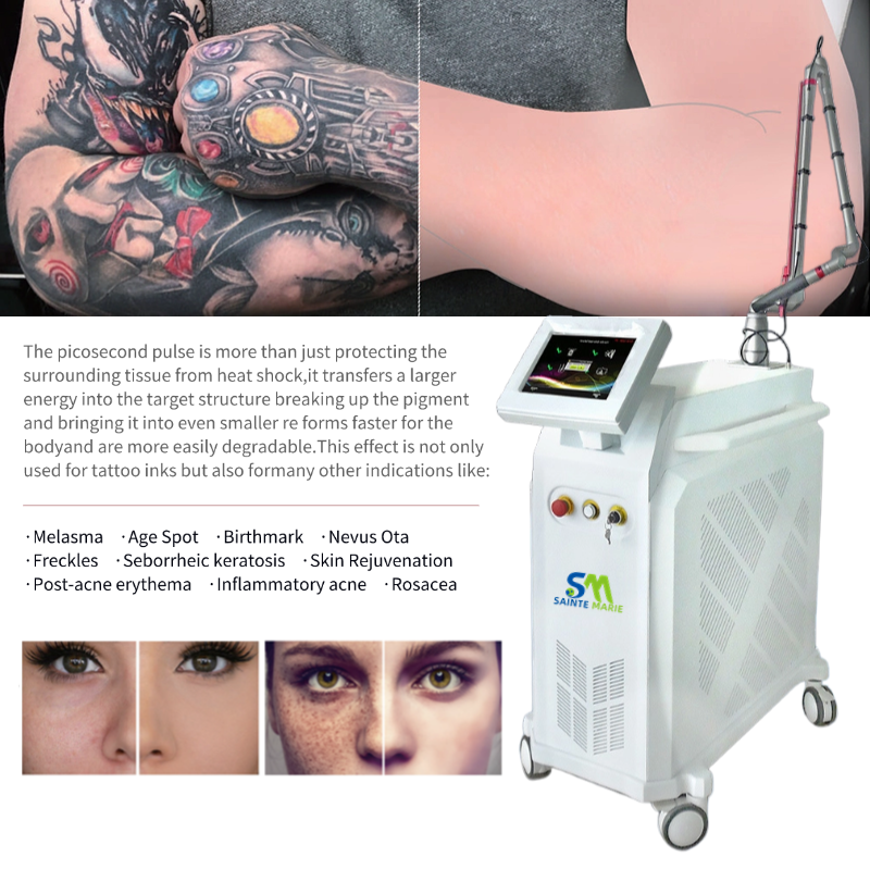 Alat Super Laser Picosecond
