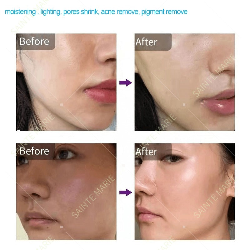 Mesotherapy Skin Boster M-1